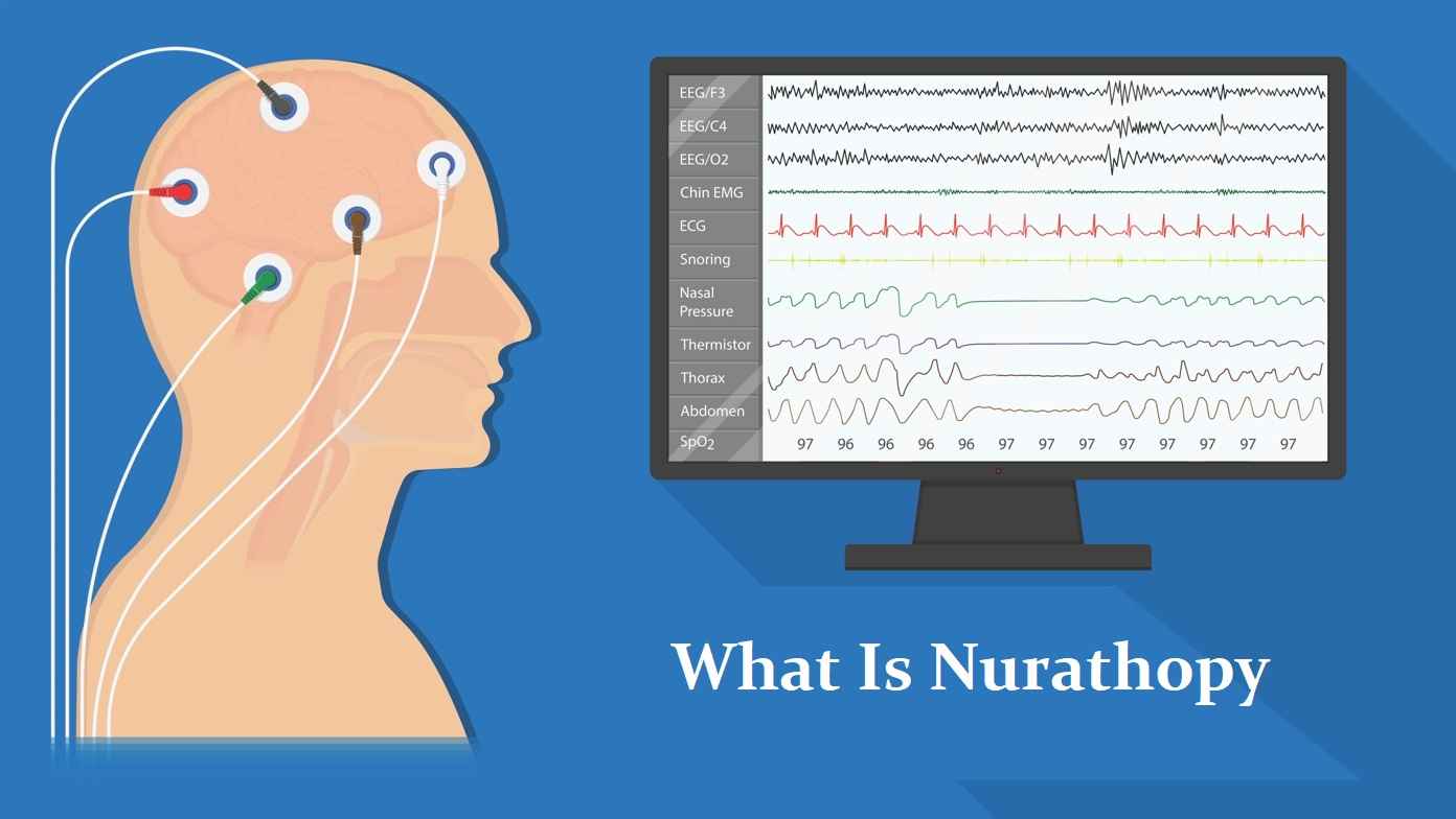 What is nurathopy